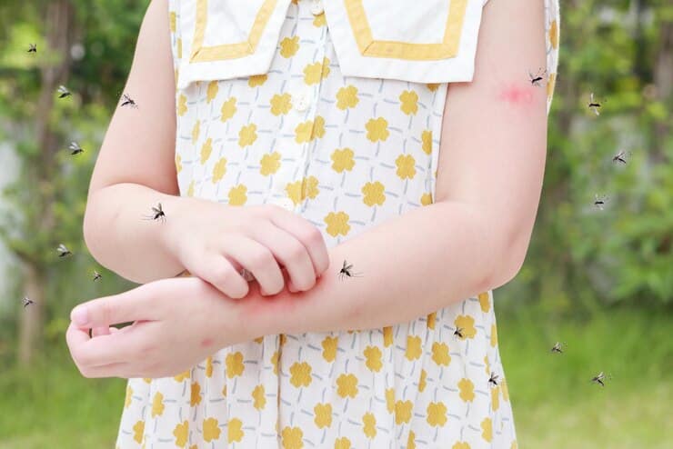 little girl has skin rash allergy itching scratching her arm with mosquitoes bite 293060 19017