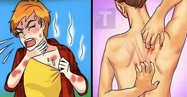 12 σιωπηλά συμπτώματα αναιμίας που δεν πρέπει να αγνοήσετε