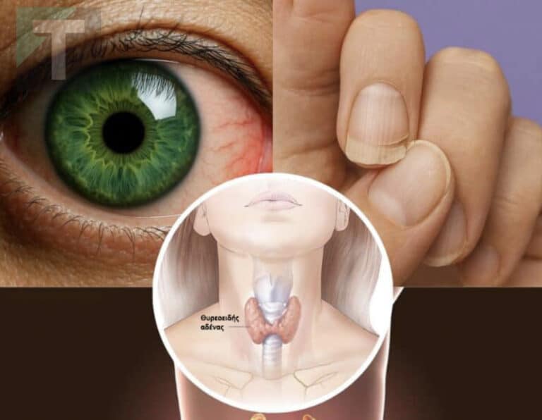 10 κρυφά σημάδια ότι ο θυρεοειδής σας δεν λειτουργεί σωστά