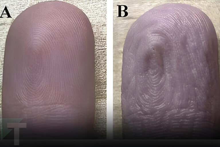 Γιατί ζαρώνουν τα δάχτυλα όταν μένουν πολλή ώρα στο νερό;