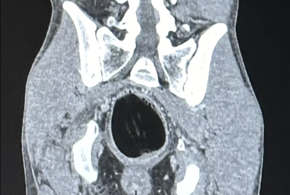 stigmiotypo othonis 2025 09 12 23.12.27