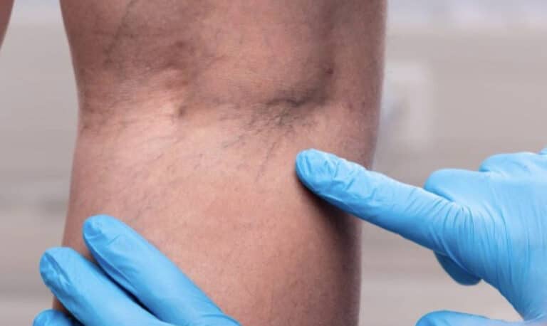 Tα χάπıα που δεν συνιστώνται γιατί μπορούν να φράξουν τις αρτηρίες και να προκαλέσουν θρόμβωση