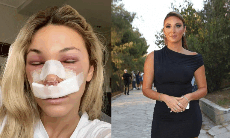 Ο κακός χαμός σήμερα στο διαδίκτυο με την πλαστική στη μύτη πασίγνωστης ξανθιάς Ελληνίδας