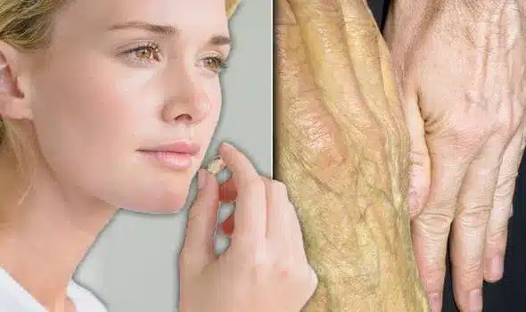 vitamin b12 deficiency symptoms jaundice 1116663