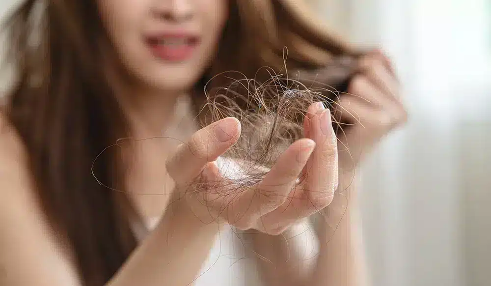 weight loss hair loss