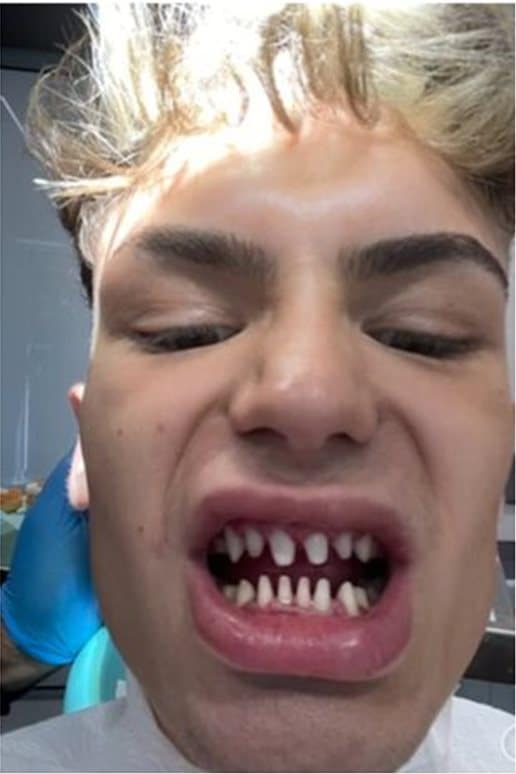 0 swns teeth botched 003 1
