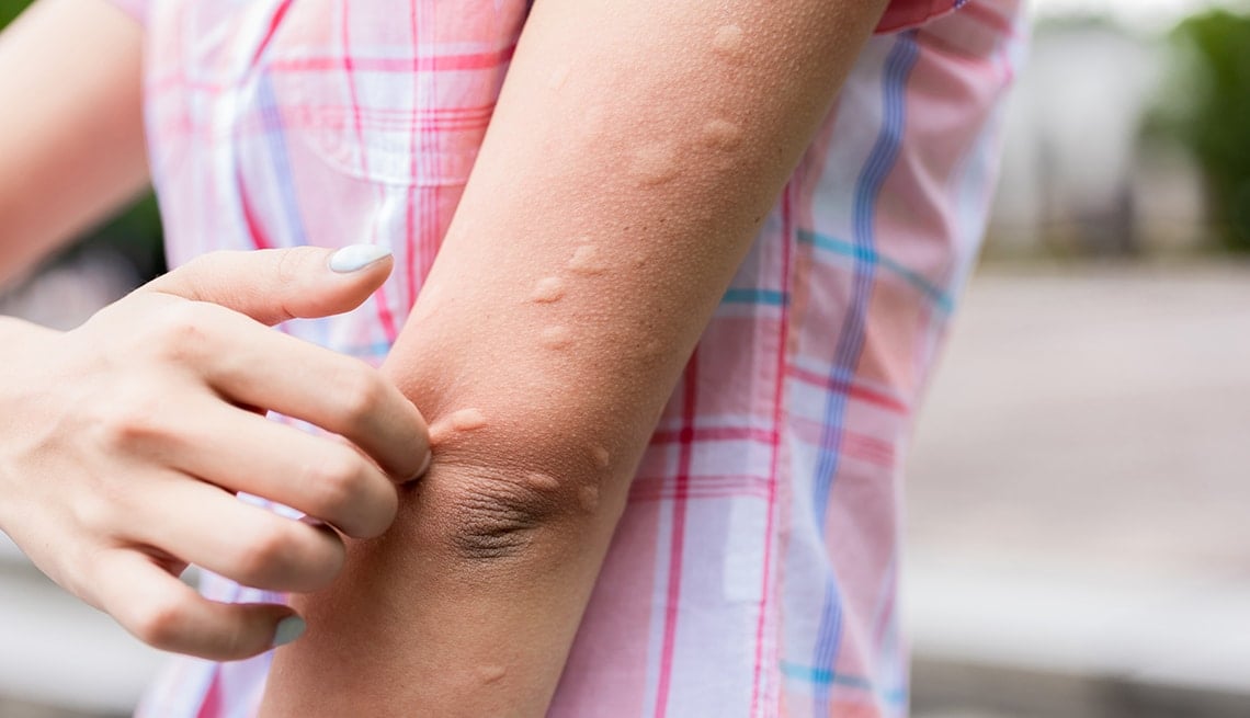 1140 what attracts mosquitoes
