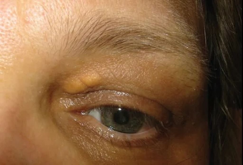 1643643390580 170862118 medicinenet