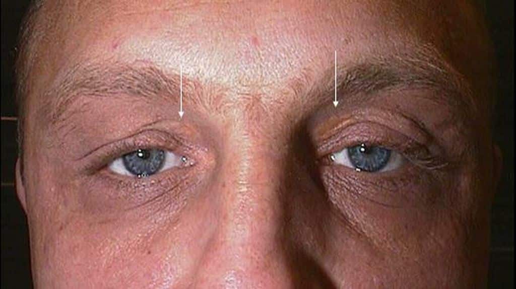 1643643390824 959433827 emedicine.medscape.com 3