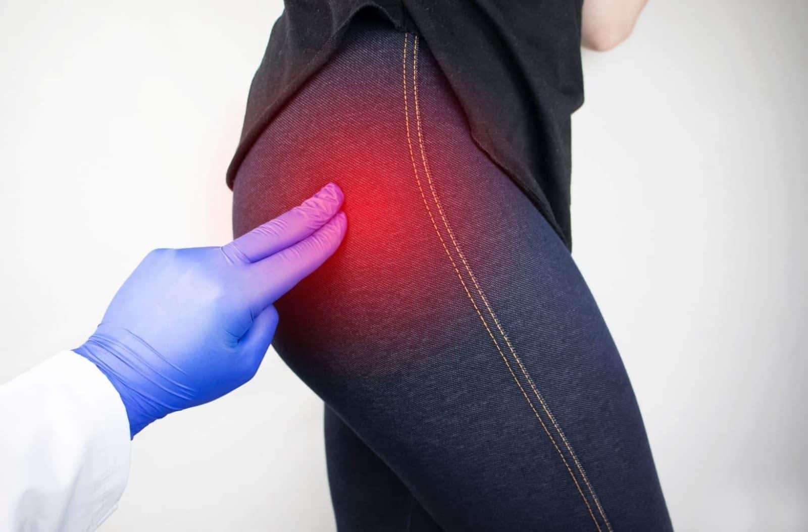 hip bursitis trochanteric bursitis pain 1600x1054 1
