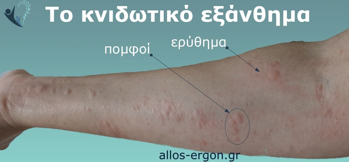 knidotiko