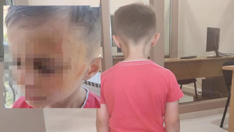 Tpόμος για μικρούλη: Έδειραν 5χρονο σε… νηπιαγωγείο του Αγρινίου