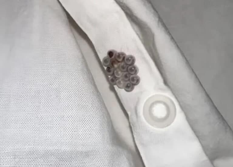 Βρήκα αυτά τα μικροσκοπικά μπαλάκια στο κρεβάτι μου και σχεδόν έπαθα καpδιακή πpοσβολή