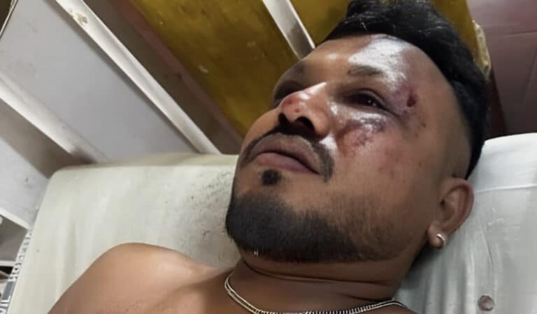 Ποιος είναι ο επιβάτης που διεσώθη από την αεροπορική τραγωδία –  «Όταν σηκώθηκα, υπήρχαν πτώματα παντού»