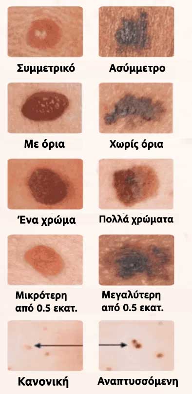 1 1