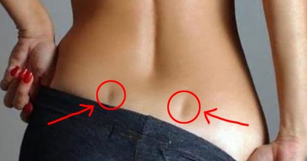 back dimples cover