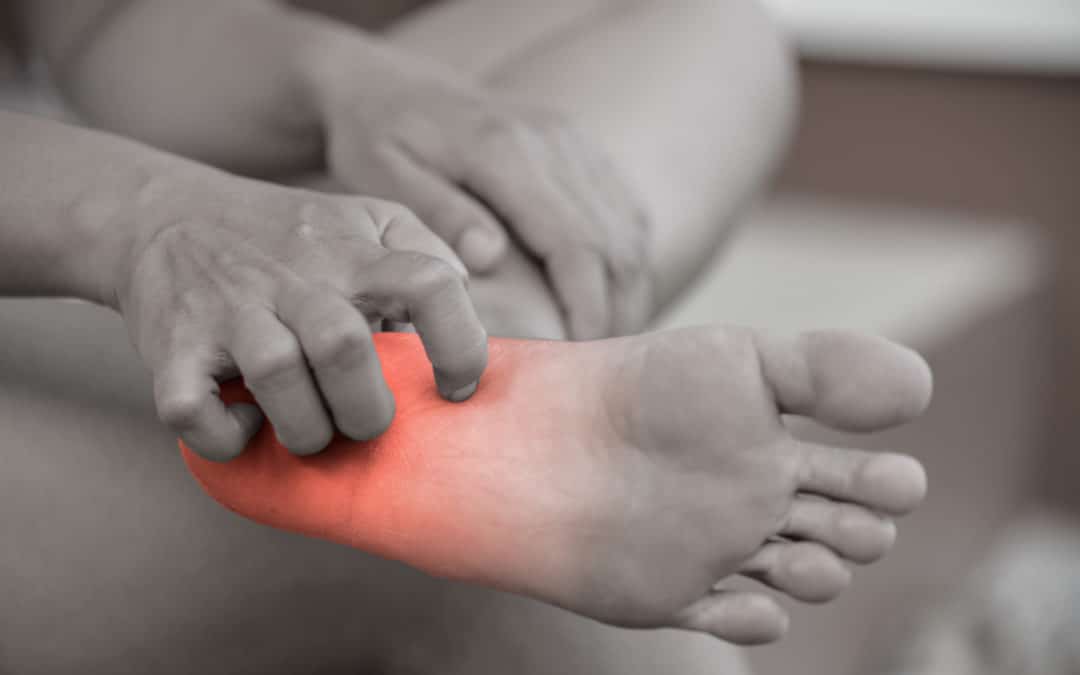 how to stop itchy feet