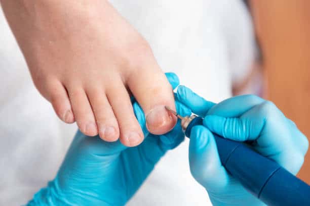 istockphoto 1404357528 612x612 1