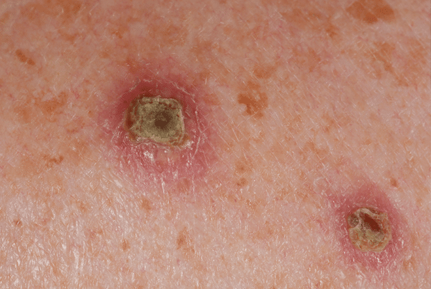 skin 20160202100656796