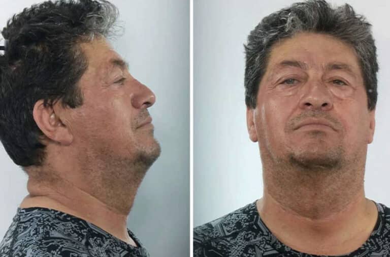 Αυτός είναι ο 63χρονος γυμνασιάρχης που προφυλακίστηκε για βıασμό μαθήτριας