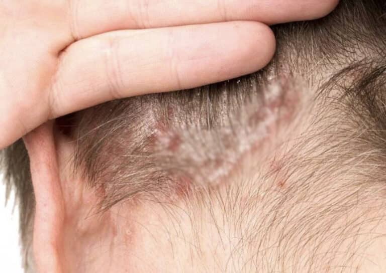 Βρήκα αυτό στο κεφάλι του γιου μου. Δεν έχουμε ιδέα τι είναι και δεν μπορούμε να πάρουμε μια διάγνωση γιατρού σύντομα.