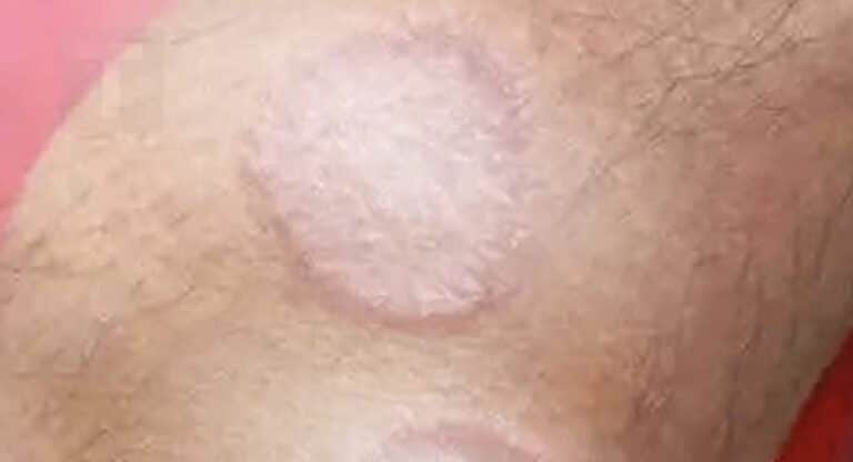 Ένα προειδοποιητικό σημάδι που δεν πρέπει να αγνοήσετε