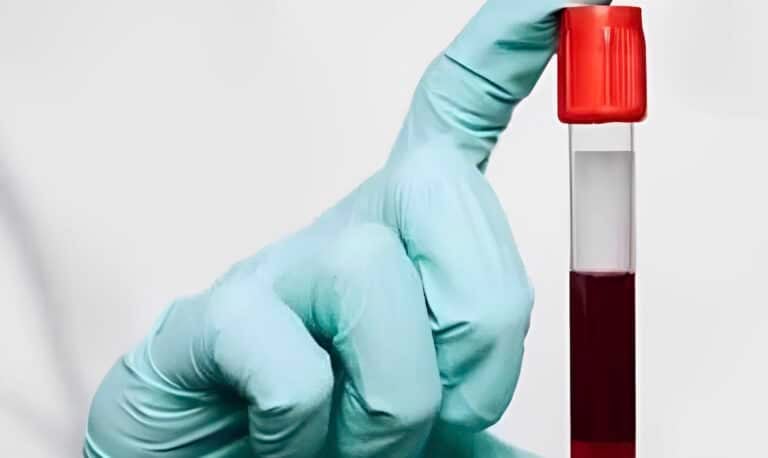 Όσοι έχουν αυτή την ομάδα αίματος θα γεράσουν πιο αργά και είναι η…