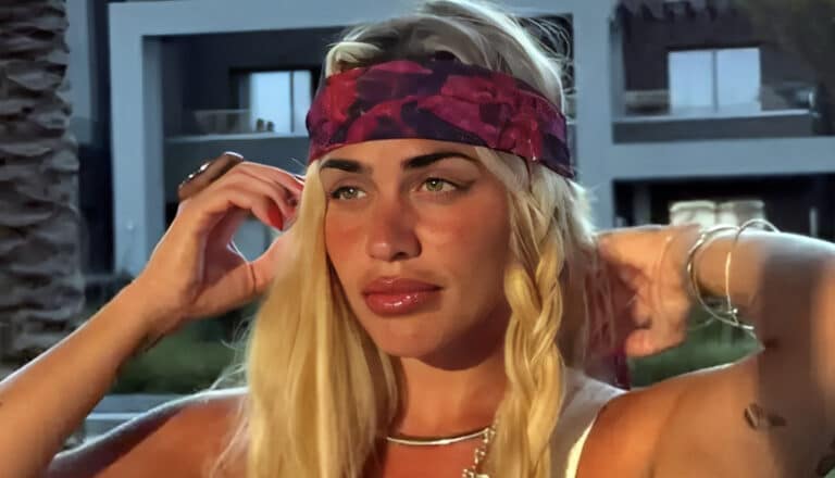 Κόνι Μεταξά: Έβγαλε το υαλουρονικό από τα τα χείλια της – Αυτός είναι ο λόγος