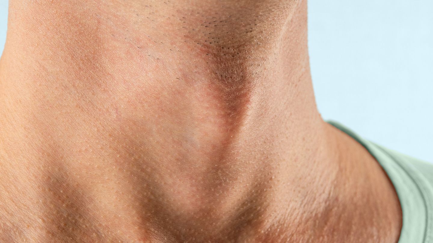 whats an adams apple 1440x810 1