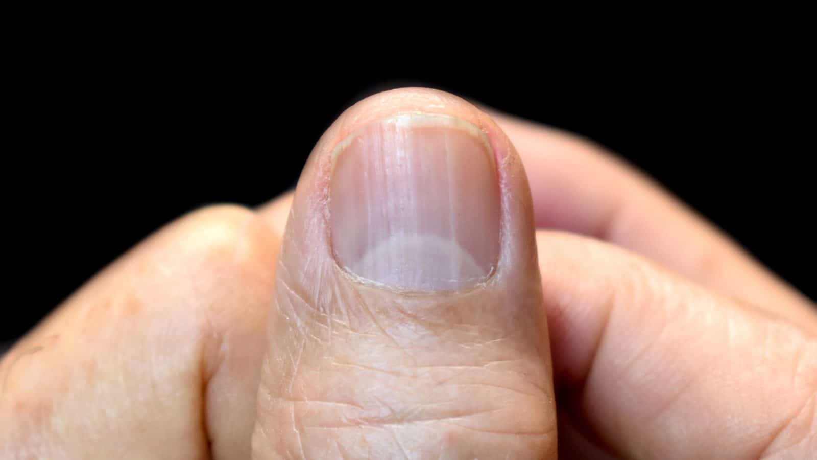 closeup lunula on nail 1449529907 1600x900 1