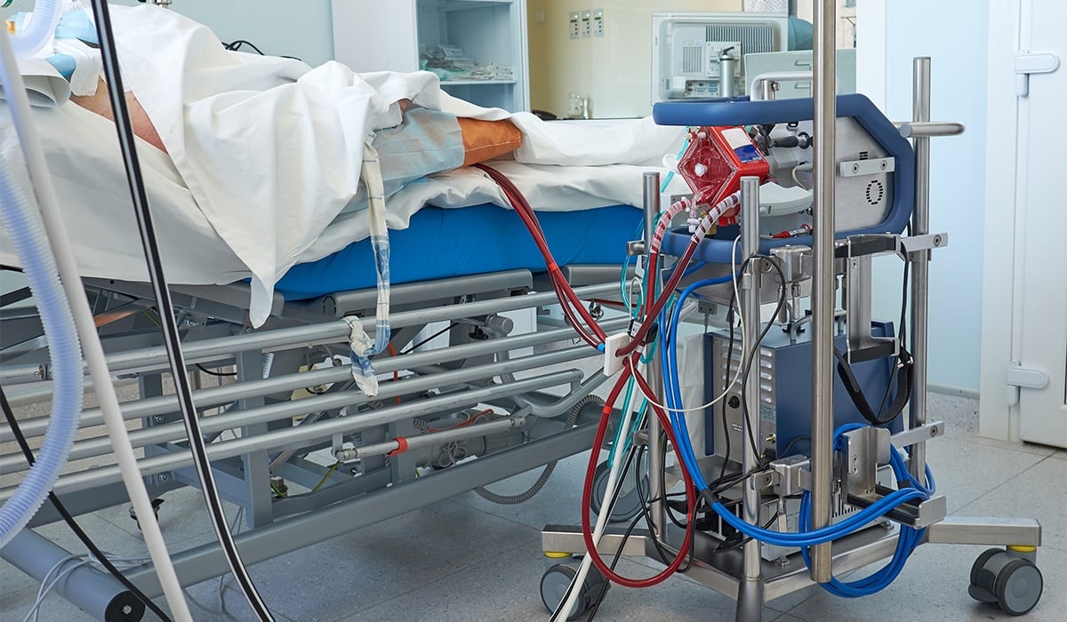 ecmo courtesy vumc