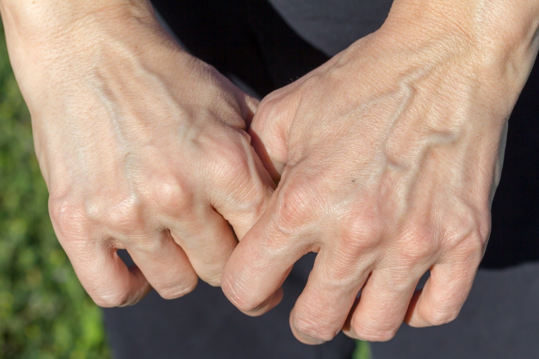 handveins