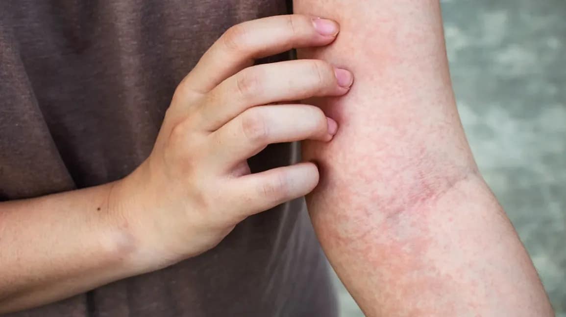 itchy skin
