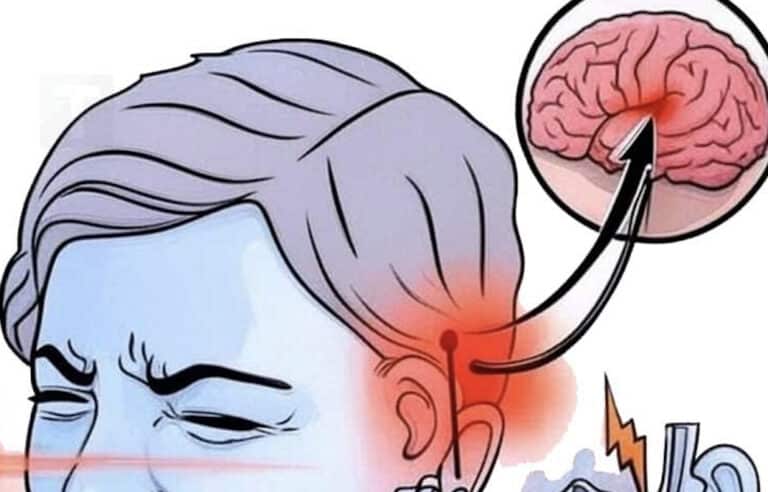 Αν ακούτε κουδούνισμα στο αυτί σας, αυτό είναι σημάδι ότι πρόκειται να υποφέρετε από…