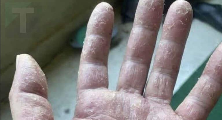 Αυτά είναι τα σημάδια ότι είναι…