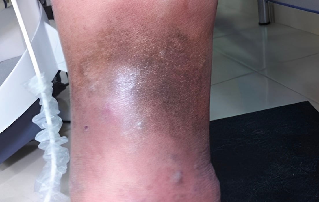 stigmiotypo othonis 2025 10 26 21.59.02