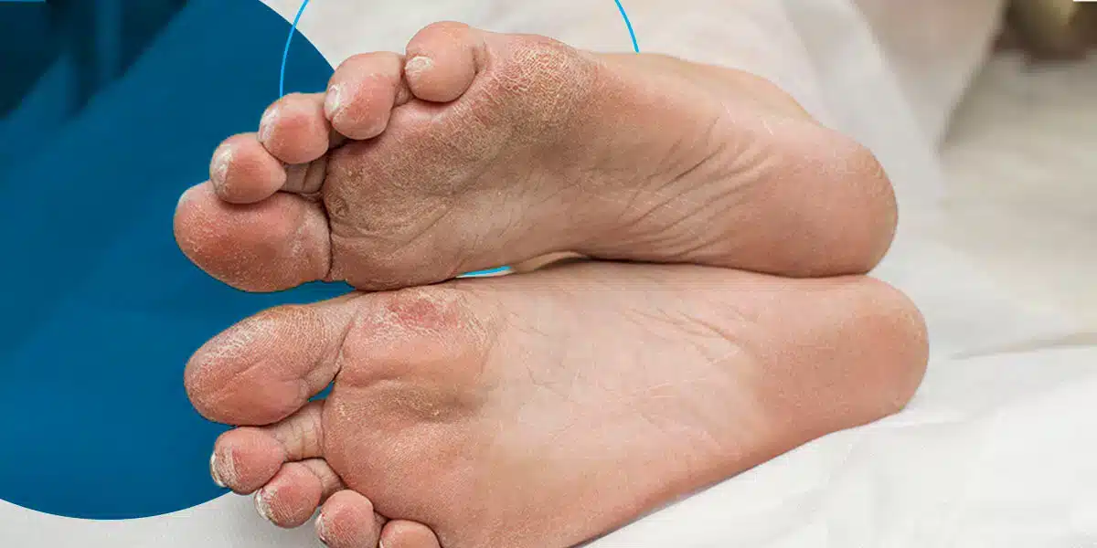 01 protect your diabetic feet before its too late.jpg