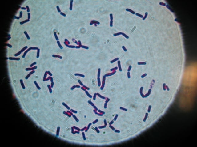 bacillus cereus 10000 mag bccdc labs