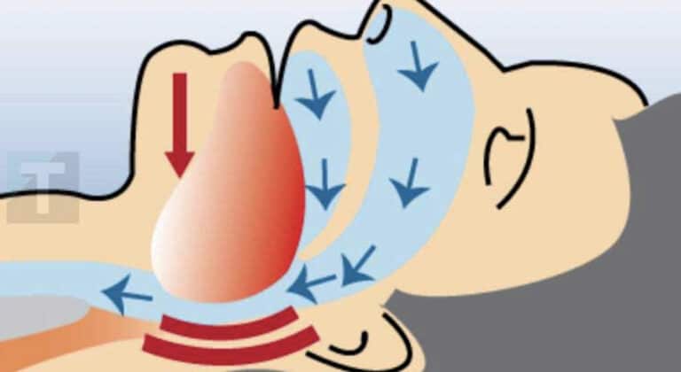 Αν σας τρέχουν τα σάλια ενώ κοιμάστε, είναι ένα σημάδι που σας δίνε το σώμα σας