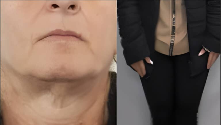 Μέγαρα: Η καφετζού που «έφαγε» 850.000 ευρώ από ανυποψίαστο 72χρονο. Τον έπεισε ότι συνεργαζόταν με Τούρκους Ιμάμηδες για να λύσει μάγια. Στο κόλπο και ο σύντροφός της