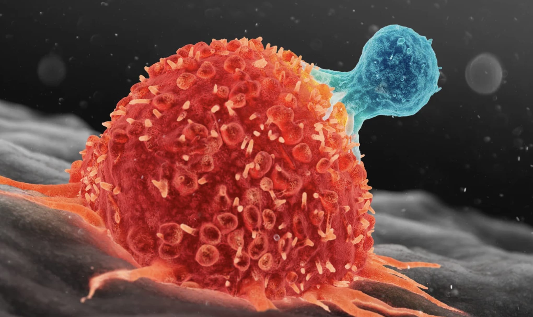 5 πρώιμα σημάδια ανάπτυξης καpκίνου στο σώμα 1 stigmiotypo othonis 2025 10 30 02.25.30