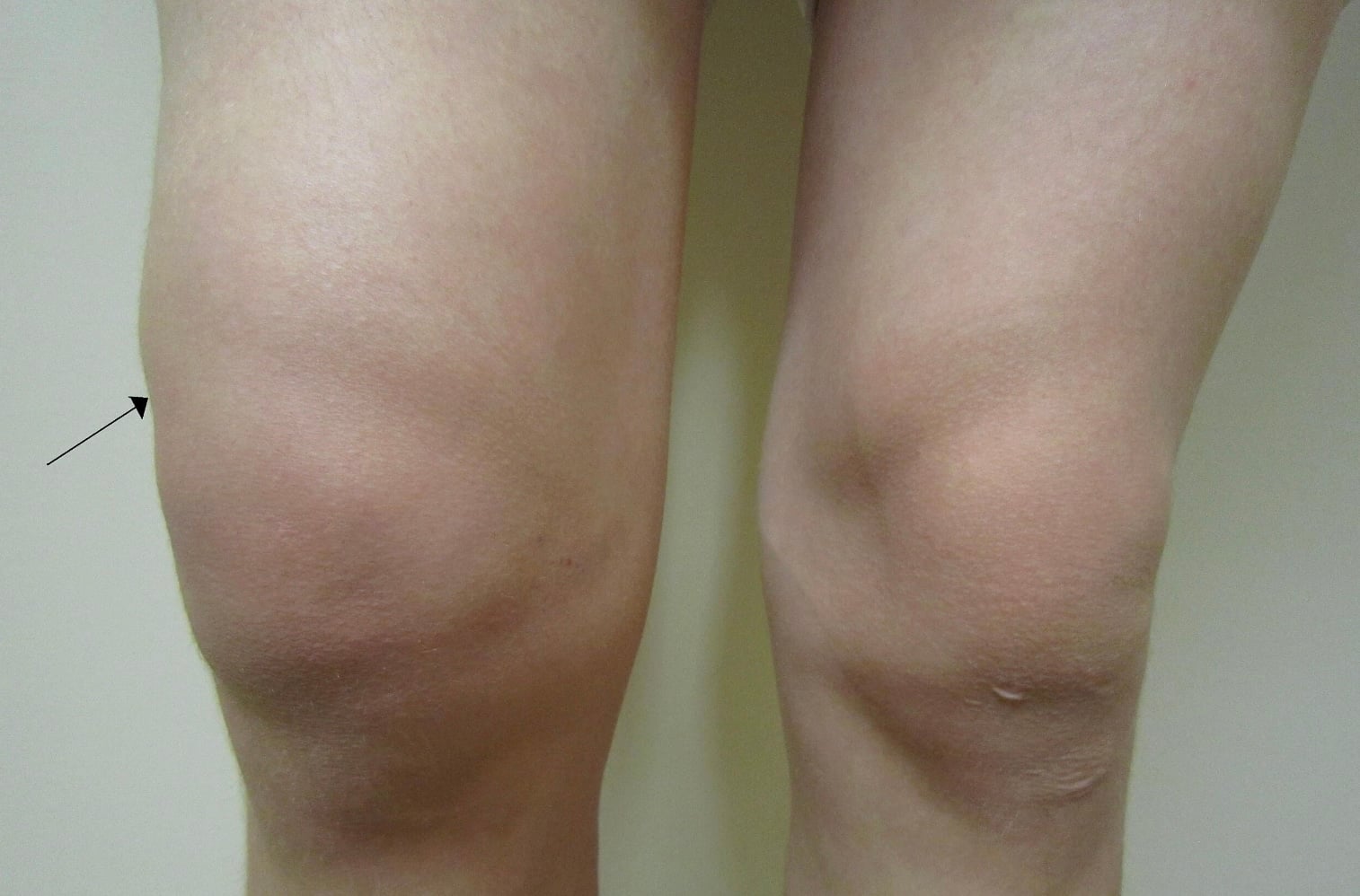 stigmiotypo othonis 2026 01 09 22.23.42