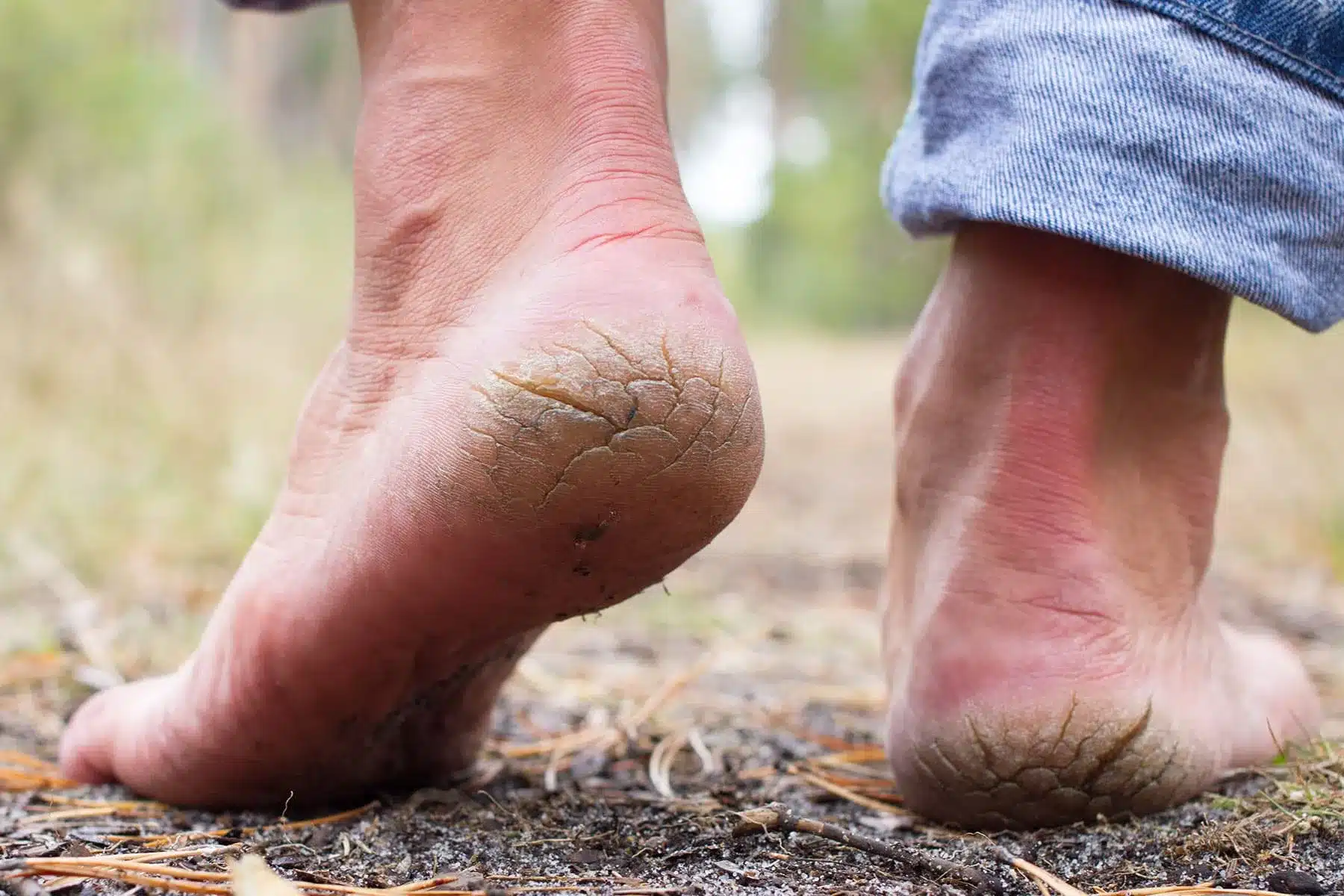 1800ss getty rf cracked heels
