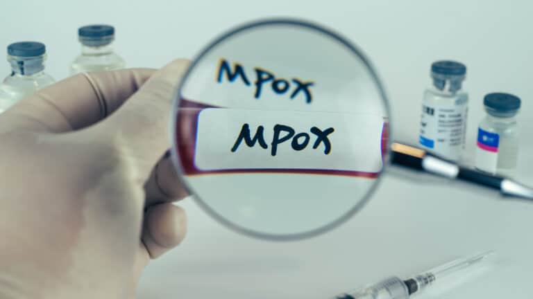 Επιφυλακή στην Ευρώπη - H επανεμφάνιση γνωστού ιού που ανησυχεί τους επιστήμονες 4 mpox test 2230117601 768x432 1