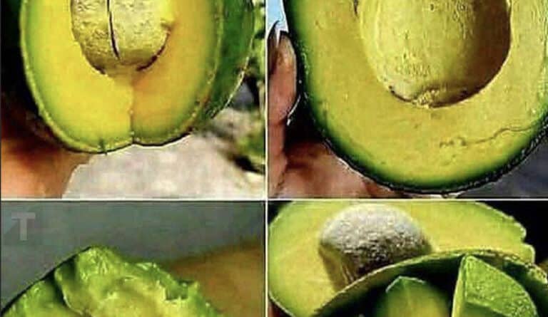 Οι γιατροί αποκαλύπτουν ότι η κατανάλωση αβοκάντο προκαλεί