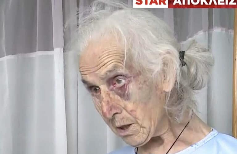Εφιάλτης για 85χρονη: Την ξυλοκόπησαν άγρια στο σπίτι της για 100 ευρώ