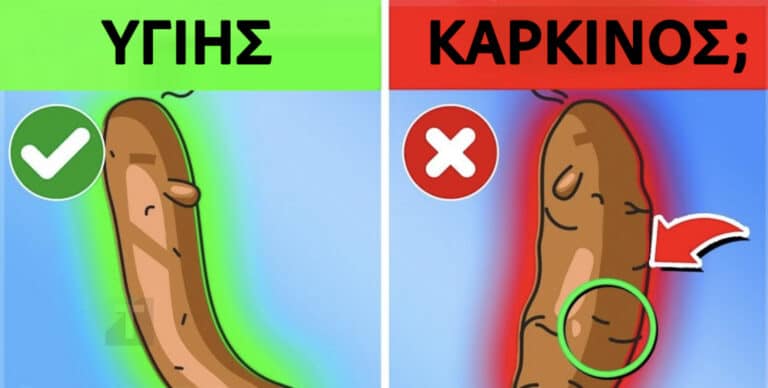 Τι αποκαλύπτει το χρώμα των κοπράνων σας για την υγεία σας