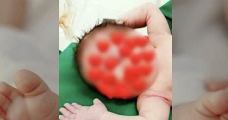 Λάρισα: Πώς έπεσε το καυτό λάδι πάνω στο σωματάκι του 18 μηνών βρέφους που μετά έπαθε ανακοπή