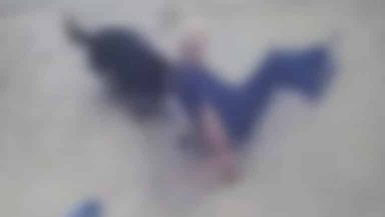 H στιγμή που Ροτβάιλερ κατασπαράζει τον ιδιοκτήτη του στη Καλαμάτα – Σκληρές εικόνες