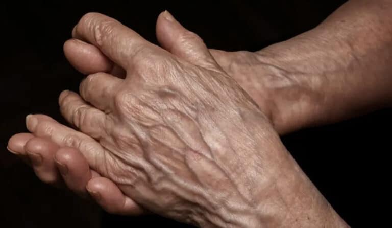 Ορατές φλέβες: Αιτίες, κίνδυνοι και πότε πρέπει να ανησυχήσετε